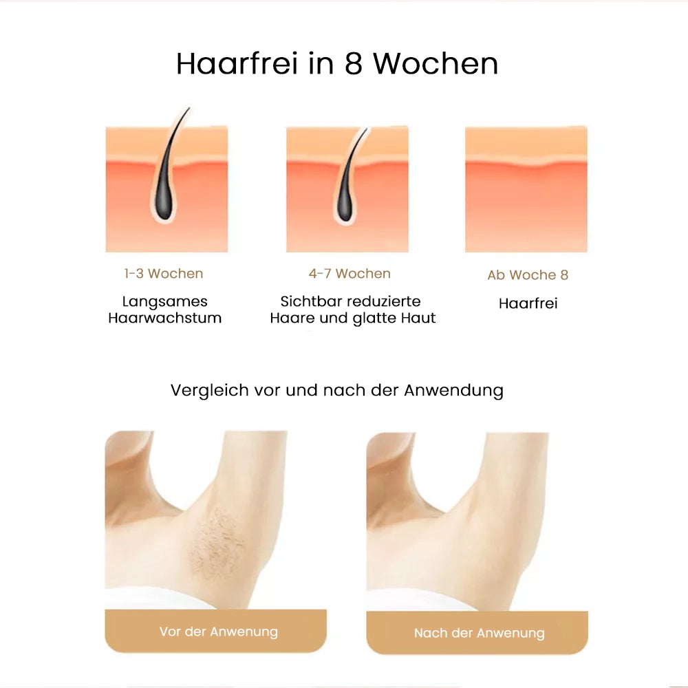 Blitzhaut IPL Laser-Haarentfernungsgerät
