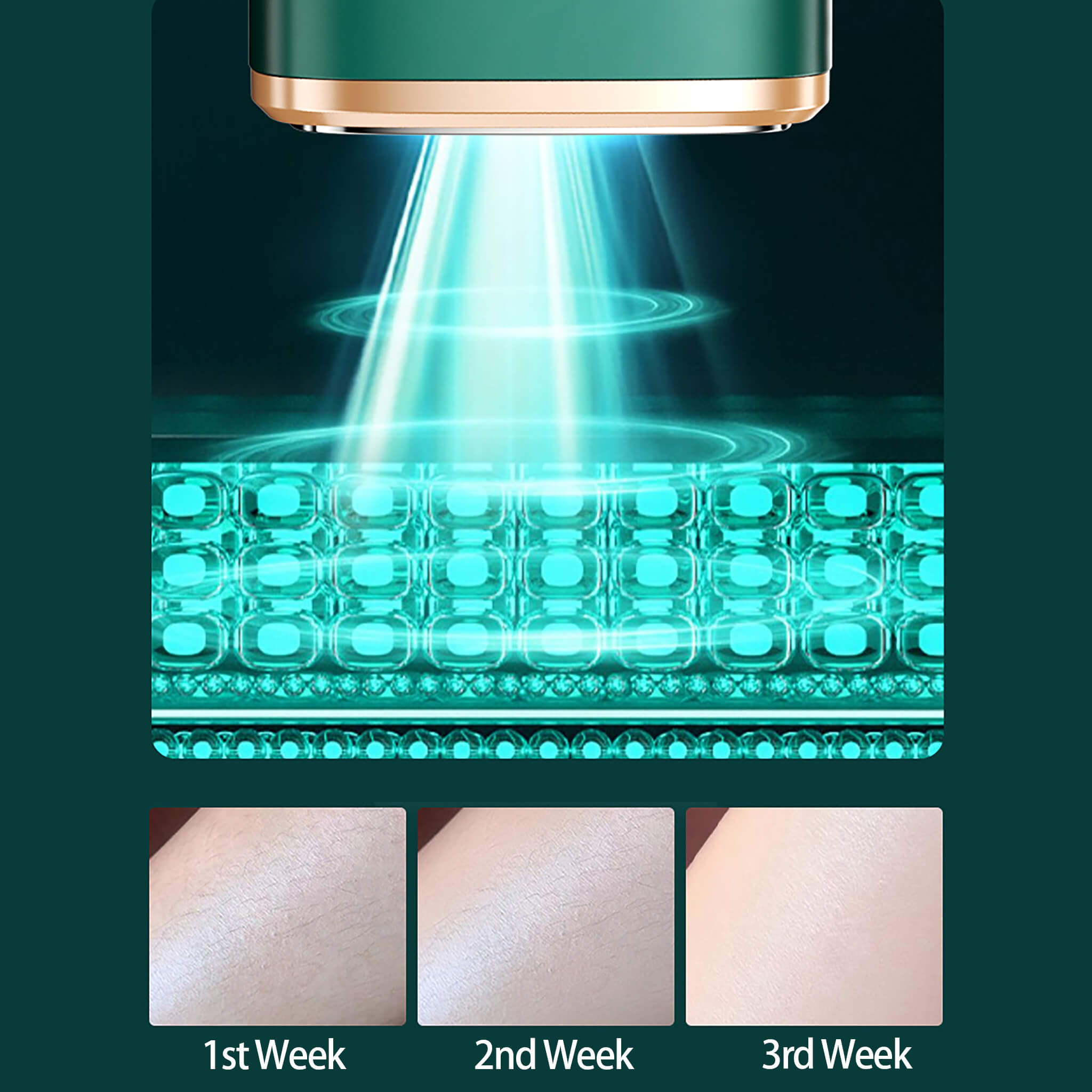 Blitz K IPL Geräte Haarentfernung